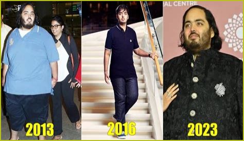 Unraveling The Mystery: What Disease Anant Ambani Is Having?